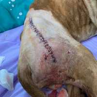 <p>His unneeded surgery stitches.</p>