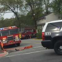 Hackensack Homeowner Puts Out Garage Fire