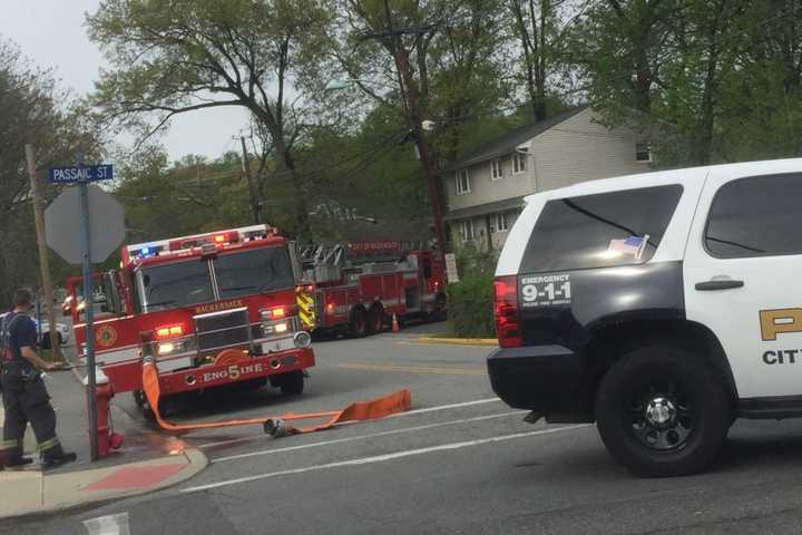 Hackensack Homeowner Puts Out Garage Fire