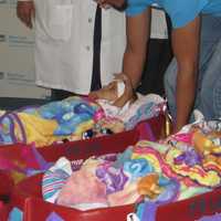 Westchester Surgeons Introduce Conjoined Twin Girls In Separate Baby Wagons