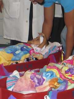 Westchester Surgeons Introduce Conjoined Twin Girls In Separate Baby Wagons