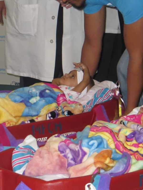 Westchester Surgeons Introduce Conjoined Twin Girls In Separate Baby Wagons