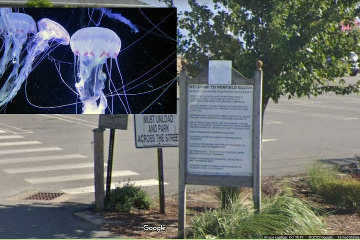 Stinging Jellyfish Reported At Multiple Fairfield Beaches, Health Officials Say