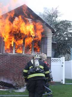 PHOTOS: Homeowner Burned Trying To Douse Lodi Fire Taken To St. Barnabas