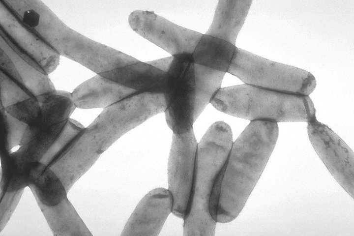 Legionnaires’ Disease Cases Reported On Long Island