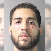 Man Kicks, Bites Woman During Long Island Robbery: Police