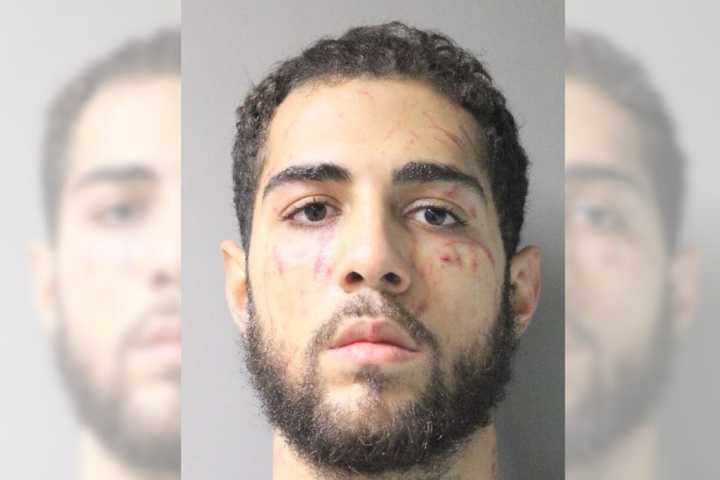 Man Kicks, Bites Woman During East Garden City Robbery: Police