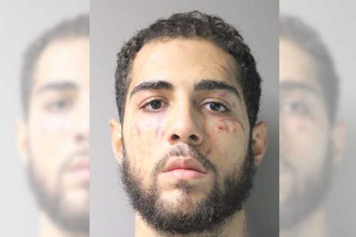 Devon Mertzel, age 24, was arrested on Tuesday, Sept. 26 for robbing a woman at a Long Island apartment complex, kicking, hitting, and biting her in the process, police said.