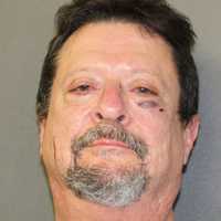 Suspect Apprehended After Assault With Baseball Bat In Maryland: Sheriff