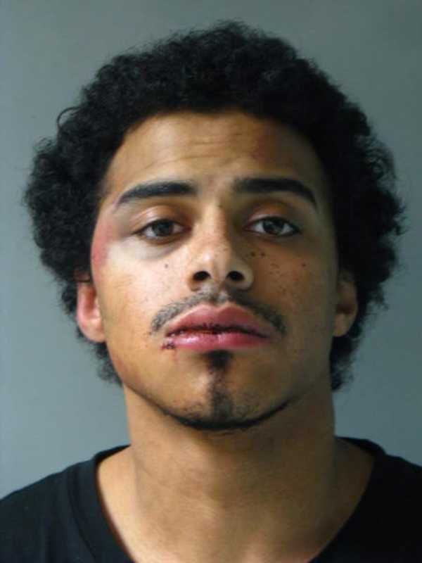 Man Accused Of Stabbing, Choking Victim During Long Island Assault