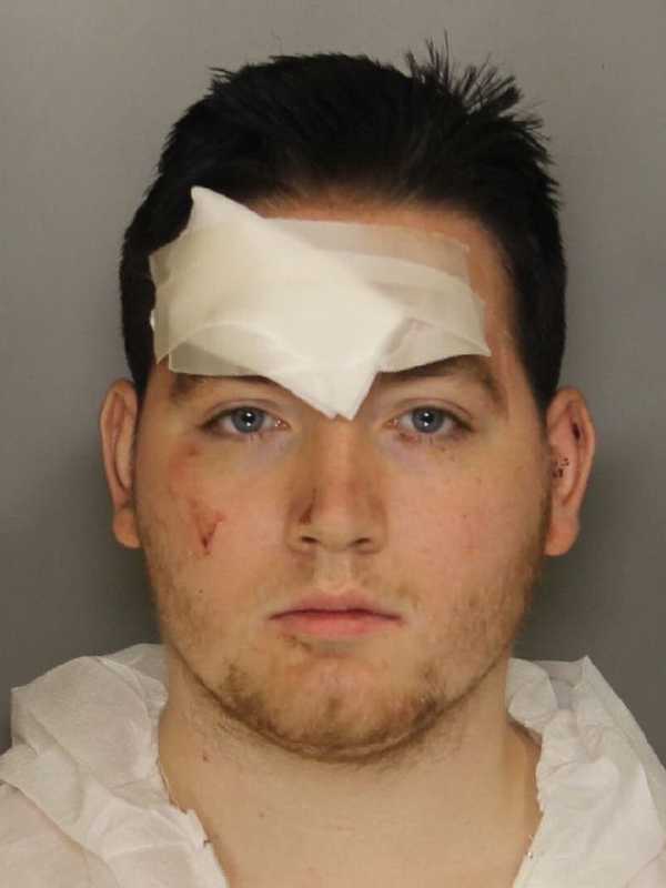 Thief Stabbed Arresting Coatesville Officer In Head, Authorities Say