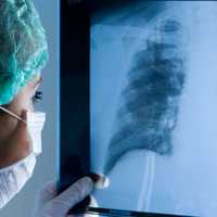 <p>Westchester Health can evaluate overall lung function of patients at one of 39 locations.</p>