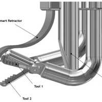 <p>The robotic arm would enter into the skull through a small opening in the range of 10–20 mm.</p>