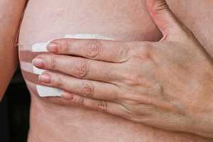 So You’re Getting A Core Needle Breast Biopsy