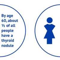 <p>Women are more likely to get thyroid nodules than men.</p>