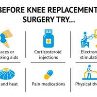 <p>The main purpose of a knee replacement is to restore your quality of life and improve function.</p>