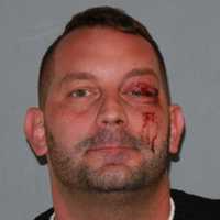 Poughkeepsie Man, 34, Charged With DWI After Crash