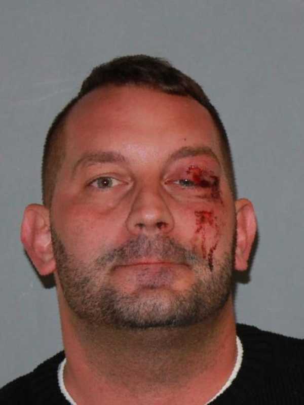 Poughkeepsie Man, 34, Charged With DWI After Crash