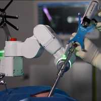 <p>A doctor performs spinal surgery using robotic navigation techniques.</p>