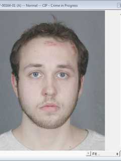 Man, 24, Faces Numerous Charges After Chase On Hutch Injures Three Officers
