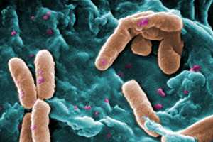 Area Doctor Discusses Potential Link Between Bacteria And Weight Loss