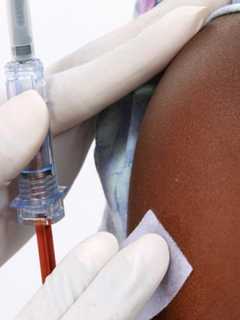 To HPV Or Not To HPV, That Is The Question