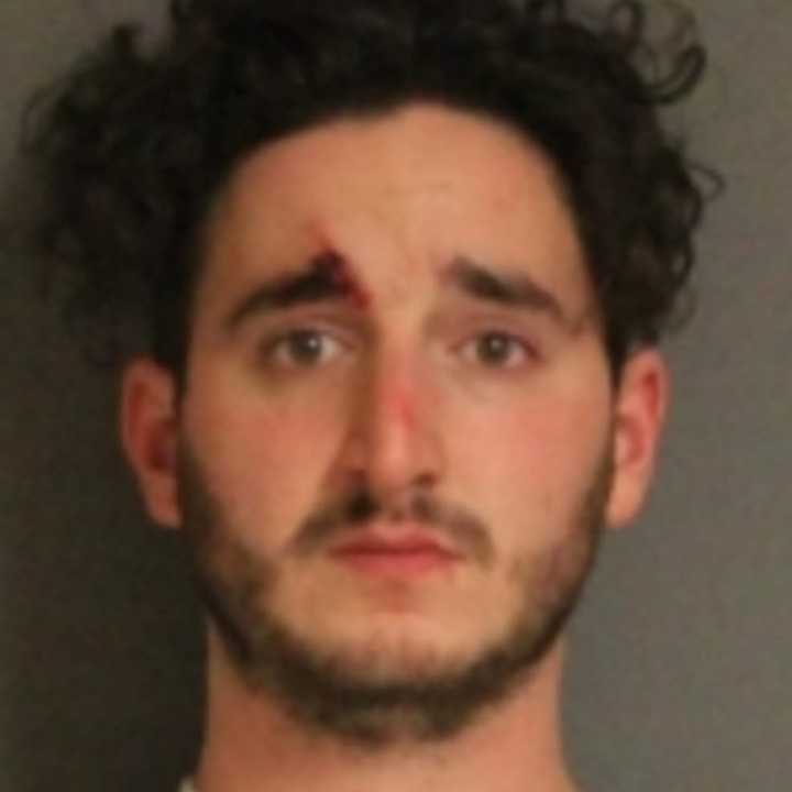 Zachary L. Tokson has been charged with criminally negligent homicide, a Class E felony.