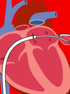 Valley Hospital Keep The Beat Going With Innovative Heart Care
