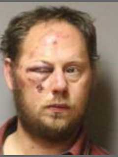 Man Fights With Police After Chase Ends In Carmel