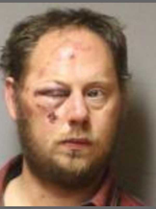 Man Fights With Police After Chase Ends In Carmel