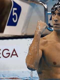 Fairfield County Acupuncturists Explain 'Giant Hickies' On Michael Phelps