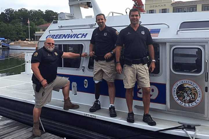 Greenwich Cop Returns To Work After Losing A Leg To Amputation