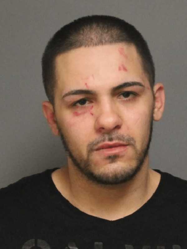 Bridgeport Man Charged With Punching Ex-Girlfriend Outside Fairfield Diner