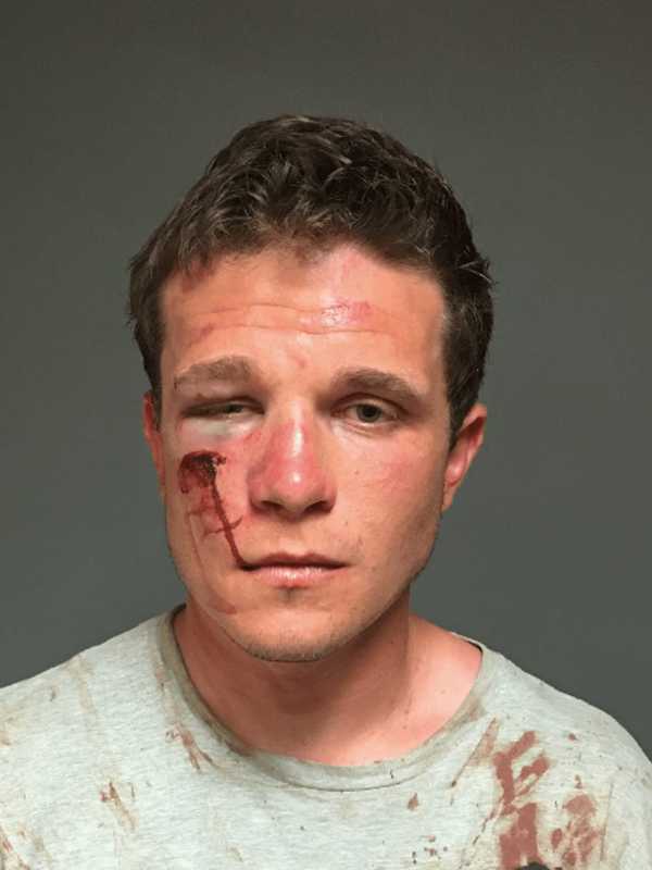 Trumbull Man Caught Lurking Outside Ex's Home, Fairfield Police Say