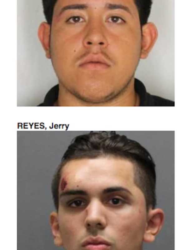 Suspected Triggerman In Shooting Of Yonkers Officer Charged In Hospital