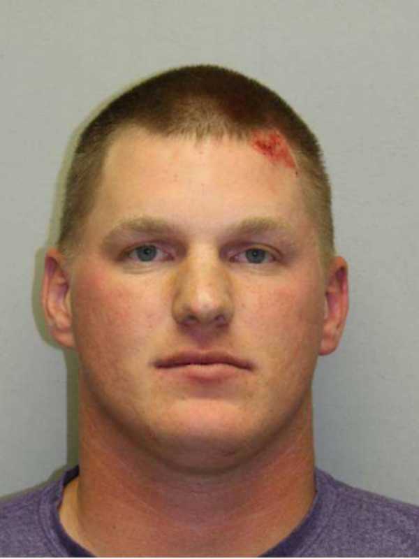 Man Nabbed For DWI After Losing Control Of Car, Hitting Tree In Putnam