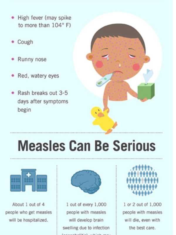 Measles Outbreak Now Reaches 52 Confirmed, Seven Suspected Cases In Rockland