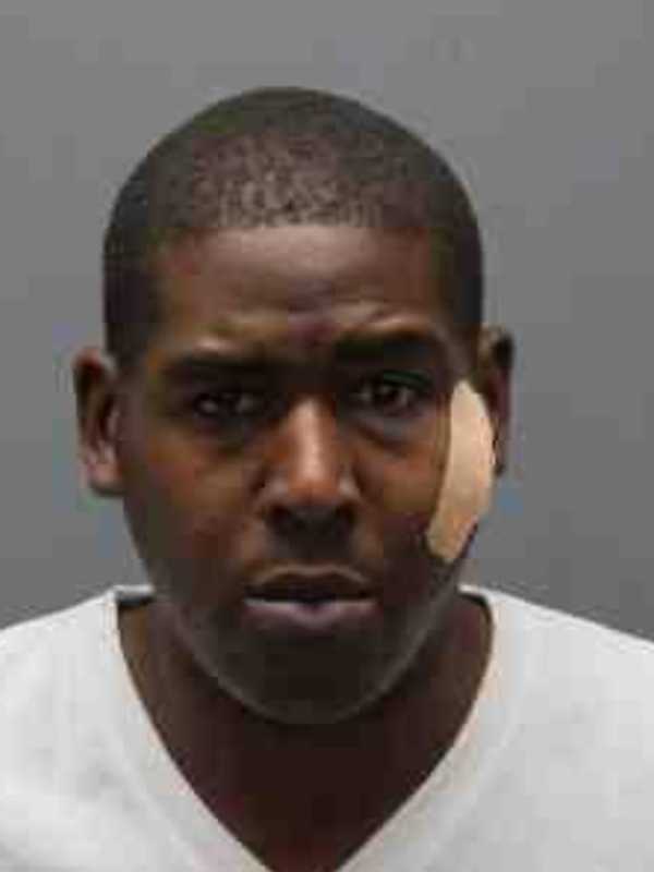 Bite To The Face In Yonkers May Lead To Life In Prison For Armed Robber