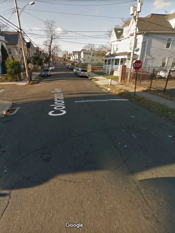 Man Shot In Face In Bridgeport