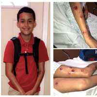 <p>Brian Caballo of Paterson was hospitalized after being ambushed by a man with a paintball gun at his front door.</p>