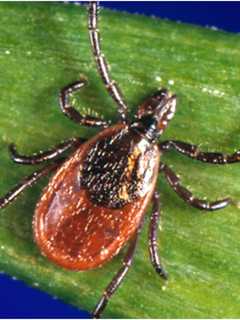 Hudson Valley Man Dies From Rare Tick-Borne Disease 'POW'