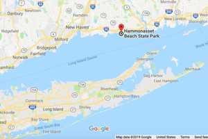 Man Has Leg Amputated After Contracting Flesh-Eating Bacteria On LI Sound