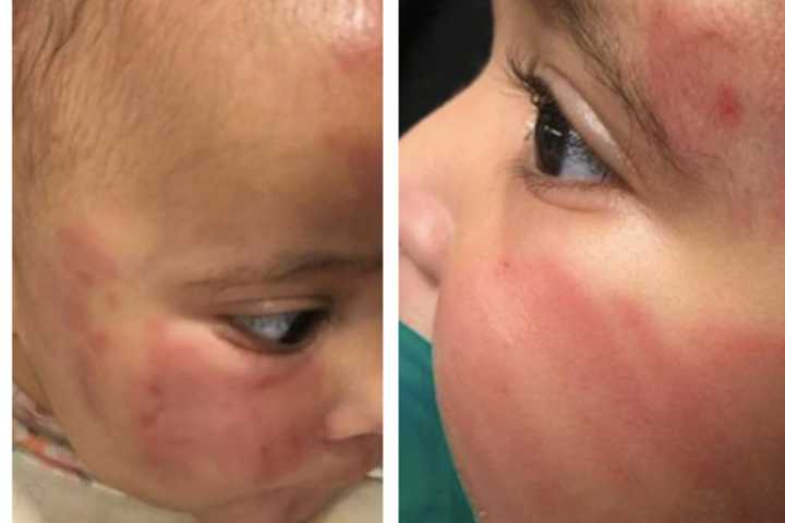 Newark Daycare Mom Blames For Baby's Bruises Shut Down: Report