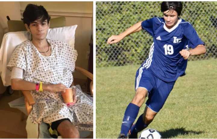 Antonio Iapicca, 15, was kneed so hard in the abdomen during an Indian Hills High School soccer game that he suffered a severed pancreas. He&#x27;s been in the hospital since the Sept. 19 game.