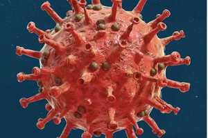 COVID-19: 12 Symptoms Of Long COVID Revealed In New Study