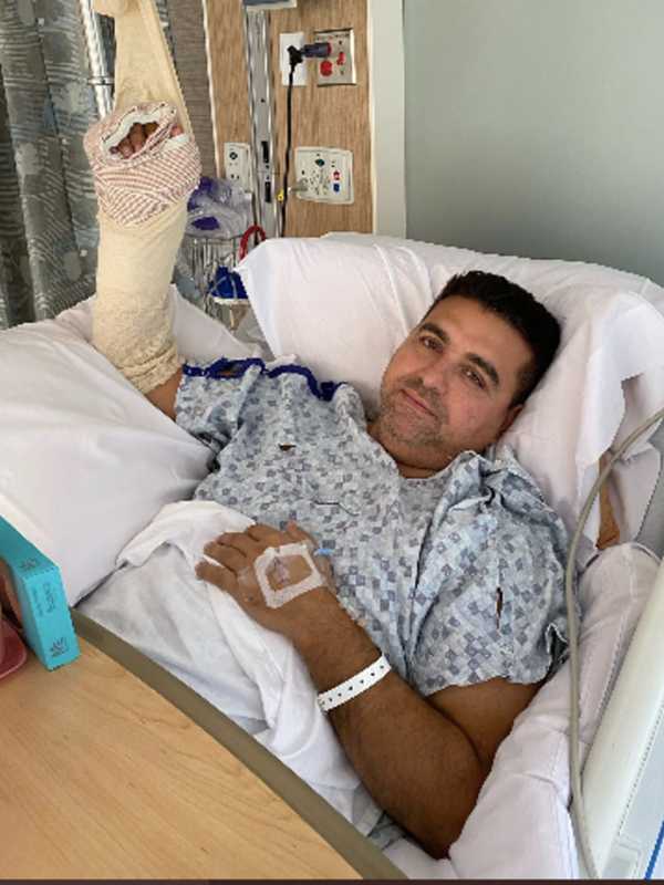 North Jersey 'Cake Boss' Buddy Valestro Injures Hand In Nasty Bowling Accident