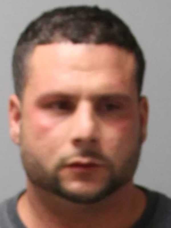 Drunk Naugatuck Motorist Injures Trooper, State Police Say