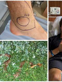 NJ Man Recovers From Venomous Snake Bite