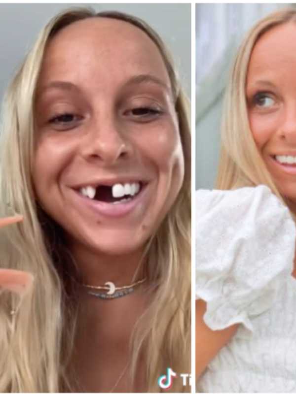 Dating With Dentures: NJ TikTok Star Finds Reasons To Smile