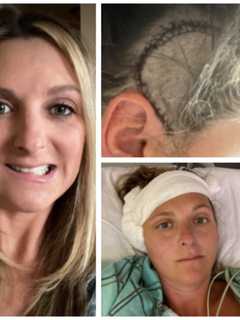 NJ Mom Faces Long Road To Recovery After Brain Tumor Removal